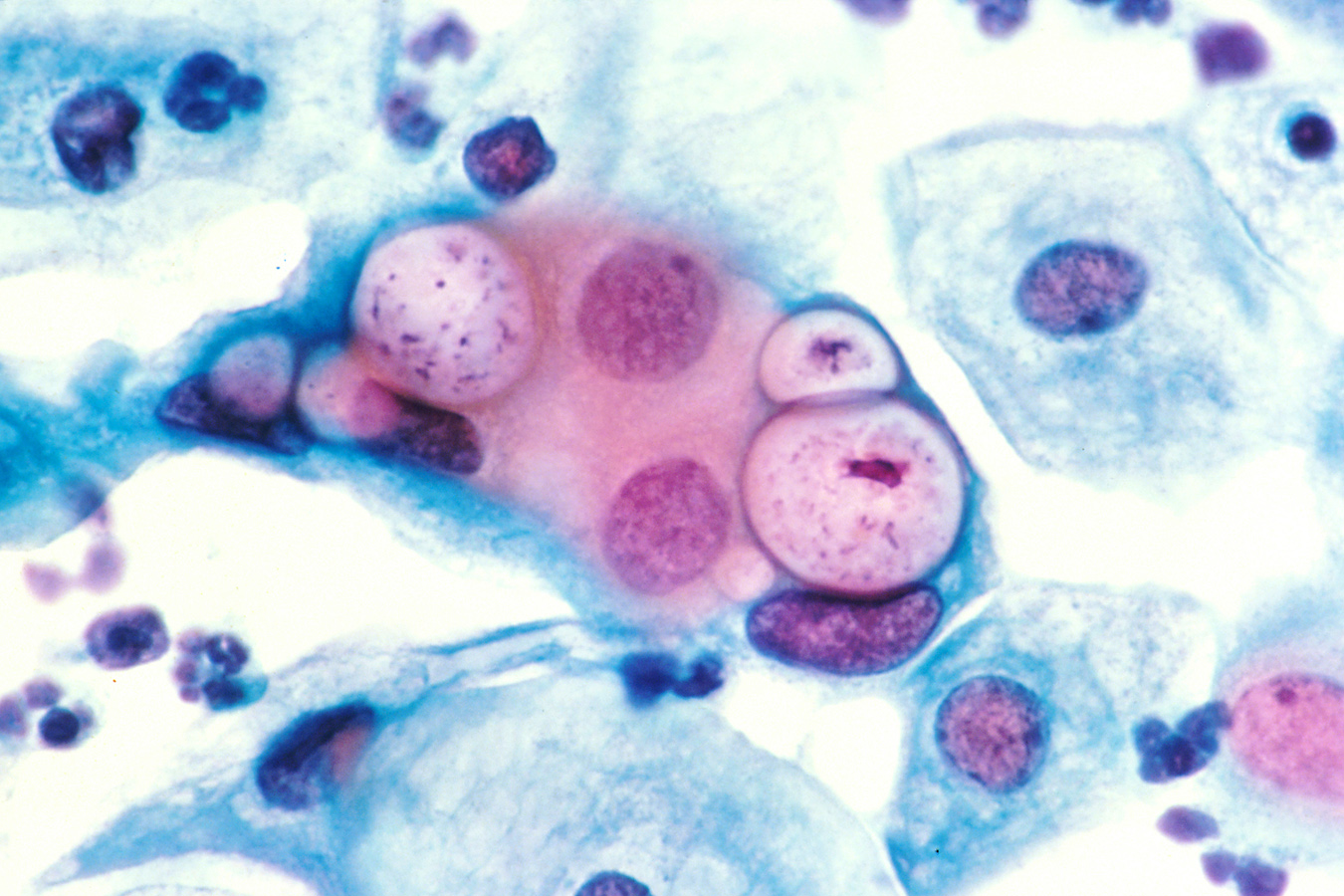 Клетки хламидий